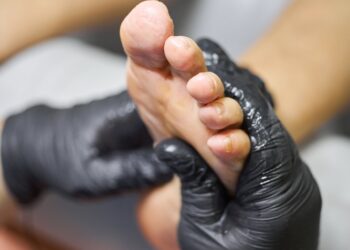 Ar podiatras gali nustatyti, ar sergu diabetu?