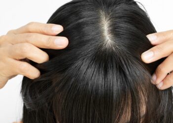 Ką daryti, jei plaukų linija nelygi?