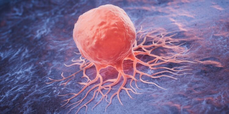 Kada bus nutrauktas Keytruda gydymas?