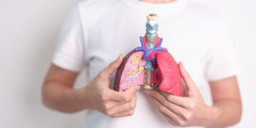 Lėtinė idiopatinė plaučių fibrozė: statistika, faktai ir svarbiausia jums