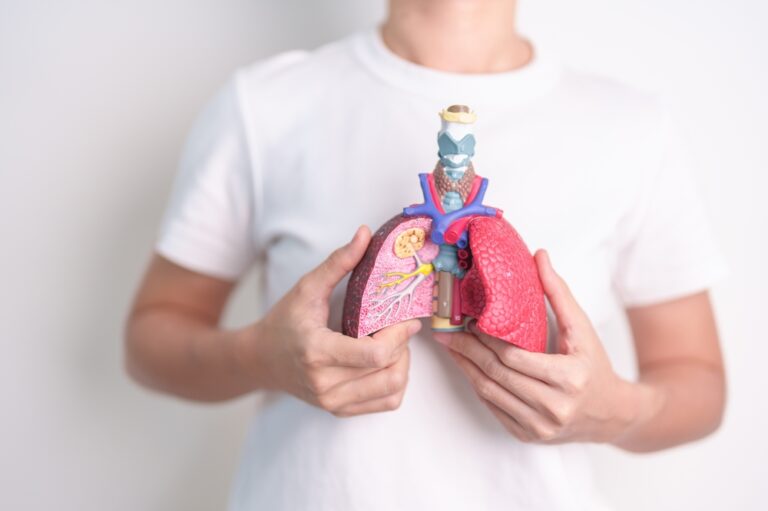 Lėtinė idiopatinė plaučių fibrozė: statistika, faktai ir svarbiausia jums