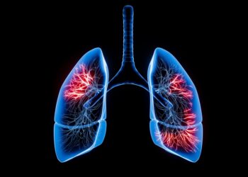 Džiaugsmas mažais dalykais sergant LOPL