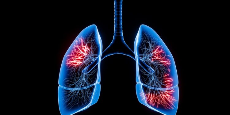 Džiaugsmas mažais dalykais sergant LOPL