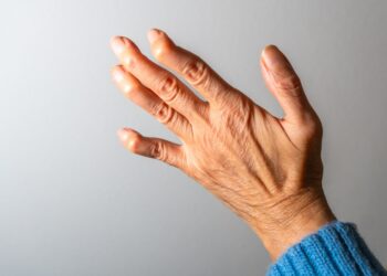 Boutonnière deformacijos gydymas