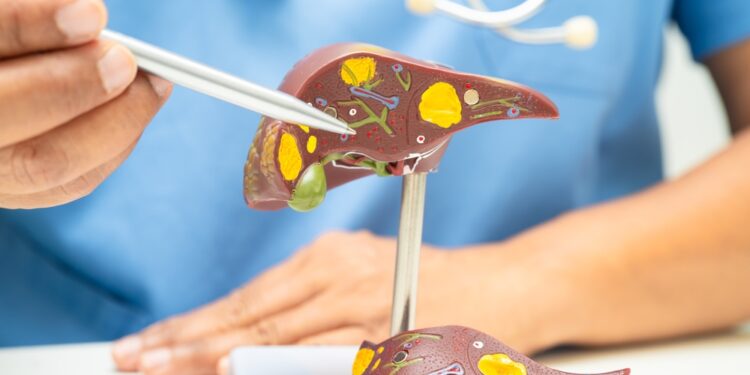 Kokios operacijos taikomos sergant ciroze?