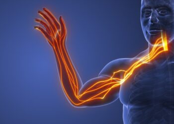 Ar užspaustas nervas gali sukelti galvos svaigimą?