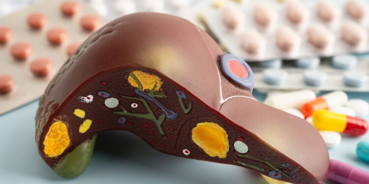 Ar riebi kepenų liga gali sukelti pilvo skausmą?