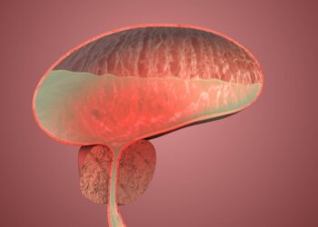 Gerybinis šlapimo pūslės navikas