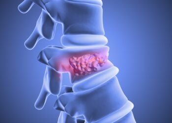 Stuburo slanksteliai ir nervai