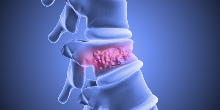 Stuburo slanksteliai ir nervai