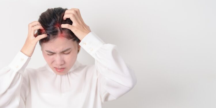 Kas yra sebopsoriazė ir kaip ją gydyti?