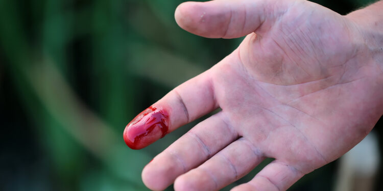 Kodėl po pirštų įsiskverbimo gali atsirasti kraujavimas?