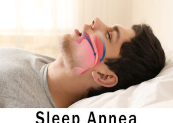 Centrinės ir obstrukcinės miego apnėjos skirtumai