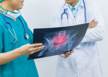 Kas yra kaulų čiulpų edema ir kaip ji gydoma?