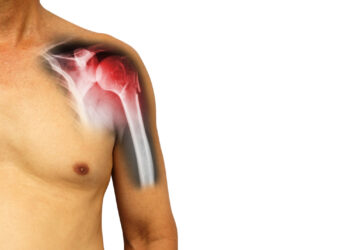 Lūžusi kaklo sritis