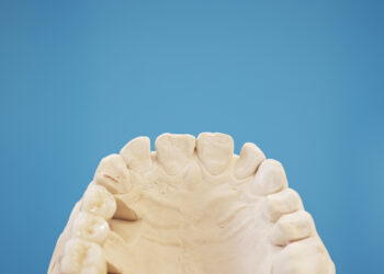 Kodėl taisyklingas sąkandis yra svarbus