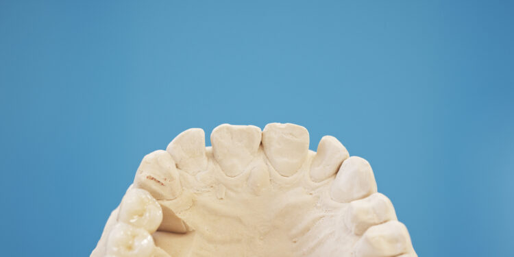 Kodėl taisyklingas sąkandis yra svarbus