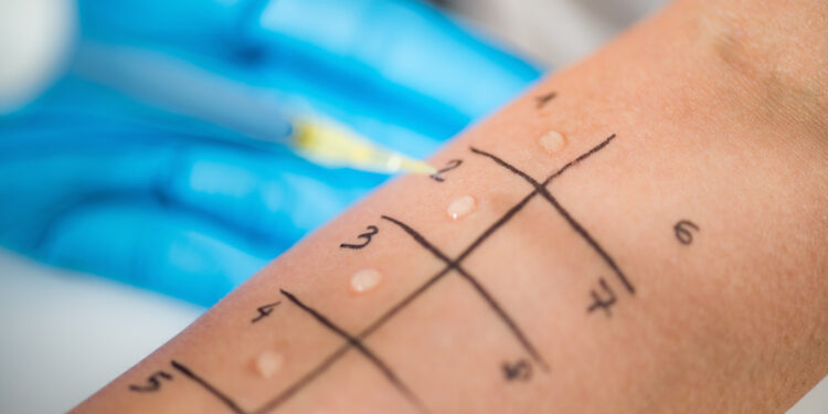 Odos pažeidimo KOH tyrimas