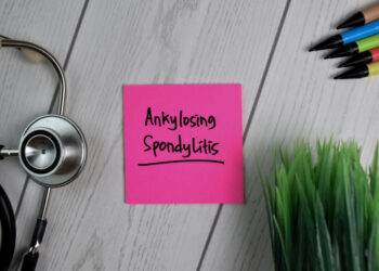 Patarimai, kaip išsirinkti tinkamą ankilozinio spondilito specialistą
