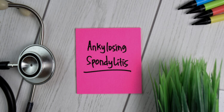 Patarimai, kaip išsirinkti tinkamą ankilozinio spondilito specialistą