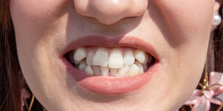 Nelygus žandikaulis