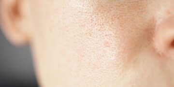 Ar riebi oda reiškia, kad turėsiu mažiau raukšlių?