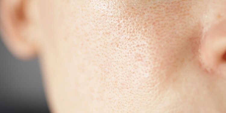 Ar riebi oda reiškia, kad turėsiu mažiau raukšlių?