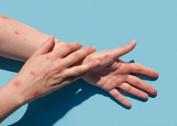 Svarbiausios žvynelinės akimirkos