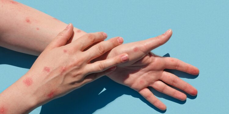 Svarbiausios žvynelinės akimirkos