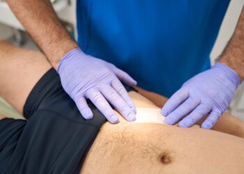 Gaktos plaukų slinkimo priežastys ir gydymo būdai