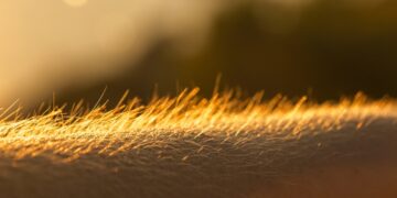 Kodėl mums pašiurpsta oda?