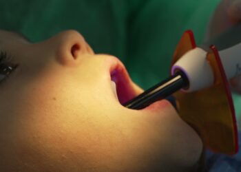 Išsamus vadovas apie dantų stulpelio ir vainikėlio atkūrimo procedūrą