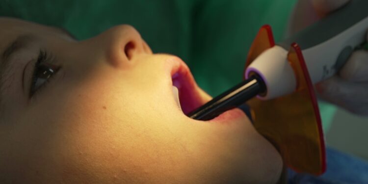 Išsamus vadovas apie dantų stulpelio ir vainikėlio atkūrimo procedūrą