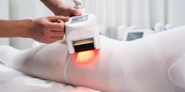 Ko tikėtis po kojų kapiliarų (voratinklinių venų) šalinimo lazeriu