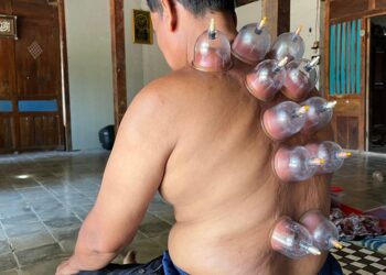 Ar akupresūros taškų terapija gali padėti gydyti erekcijos sutrikimus?