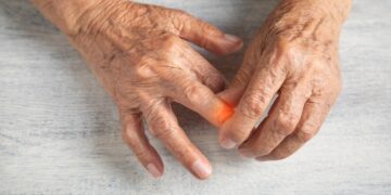 Pirštų sąnarių skausmas