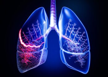 Nesmulkialąstinis plaučių vėžys: 10 svarbiausių sąvokų