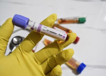 C1 esterazės inhibitoriaus tyrimas: paskirtis, atlikimas ir galimi pavojai