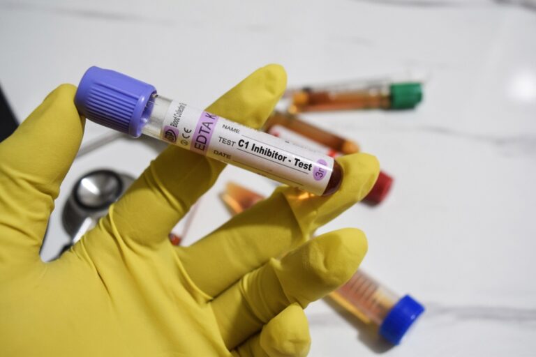 C1 esterazės inhibitoriaus tyrimas: paskirtis, atlikimas ir galimi pavojai
