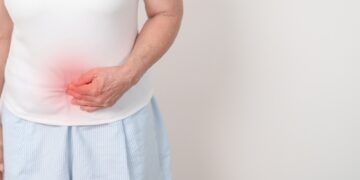 Ar rūgšties refliuksas susijęs su dirgliosios žarnos sindromu (DŽS)?