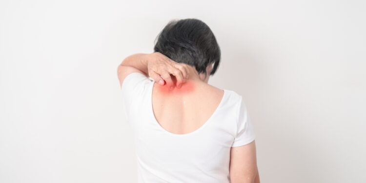 5 afirmacijos, padėsiančios sustiprinti pasitikėjimą savimi sergant psoriaze