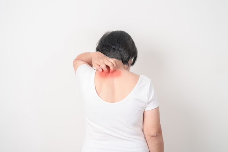 5 afirmacijos, padėsiančios sustiprinti pasitikėjimą savimi sergant psoriaze