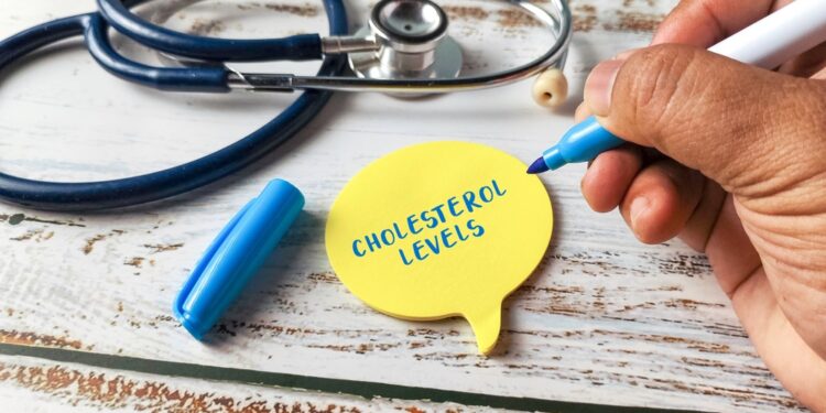 Ar galiu valgyti sūrį, jei turiu padidėjusį cholesterolį?