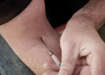 Injekciniai ar geriamieji vaistai sergant psoriaziniu artritu: ką rinktis?