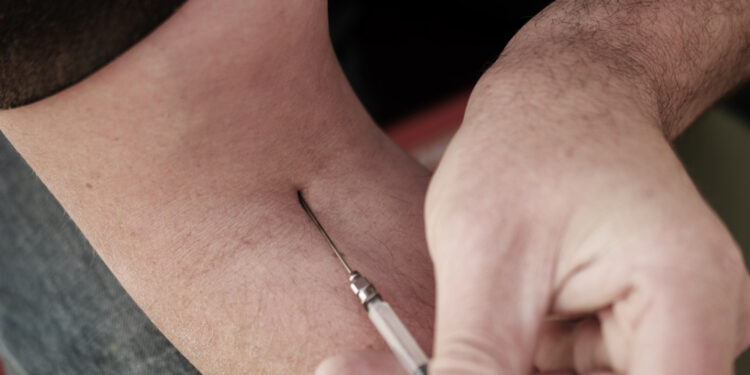 Injekciniai ar geriamieji vaistai sergant psoriaziniu artritu: ką rinktis?