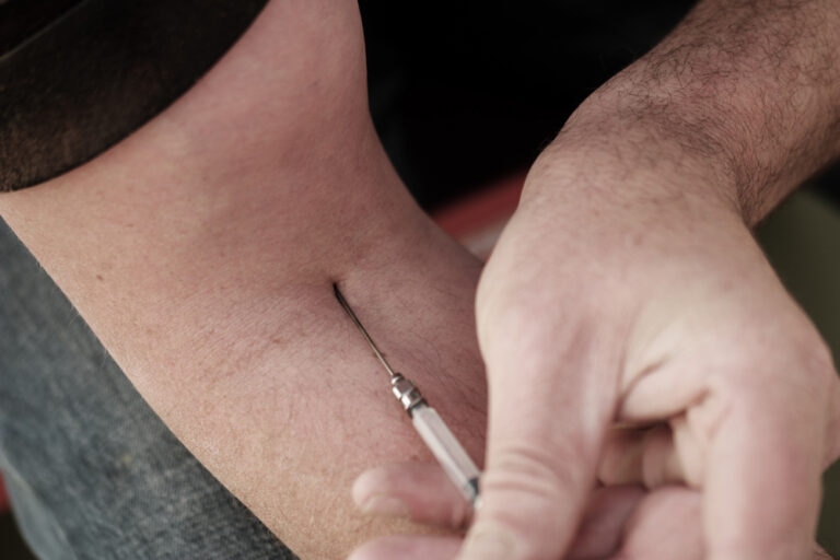 Injekciniai ar geriamieji vaistai sergant psoriaziniu artritu: ką rinktis?