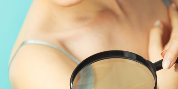 Kaip orgazmai veikia jūsų odą?