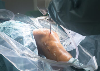 Kelio sąnario keitimo operacijos eiga