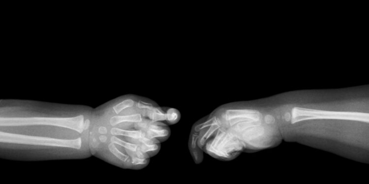 Rankos rentgeno nuotraukos