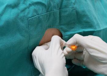 Smegenų skysčio pasėlis